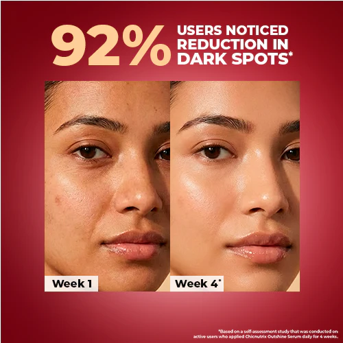 Korean Dark Spot Correction Outshine Serum - Image 4